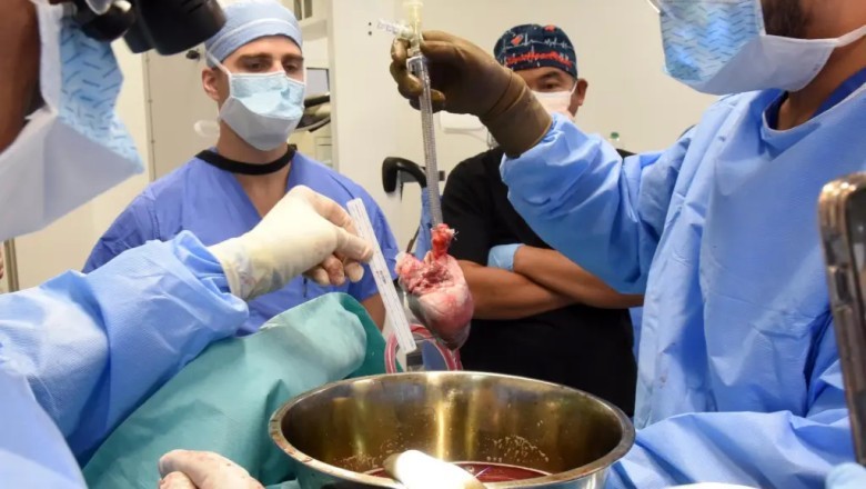 US surgeons perform world’s 2nd pig heart transplant in bid to save dying man