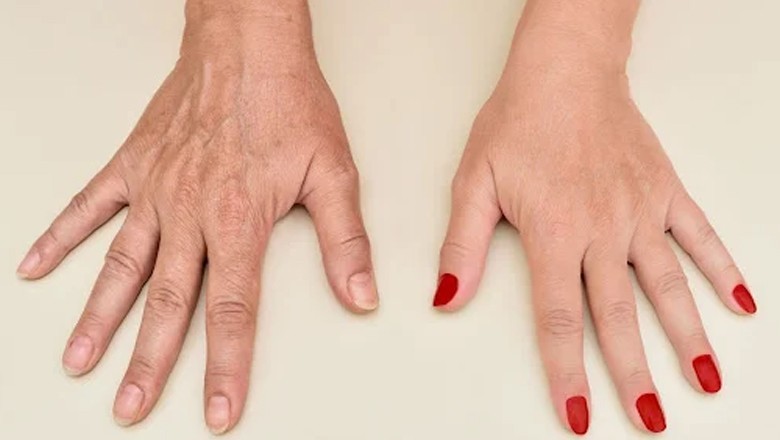 Scientists find key mechanism to slow down ageing