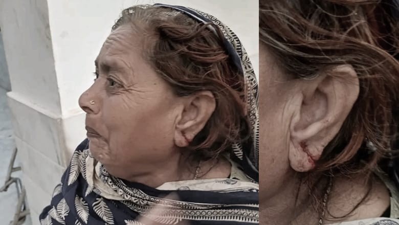 Miscreants cut off woman's ear to snatch gold earrings at Qalandar Lal Shehbaz's shrine