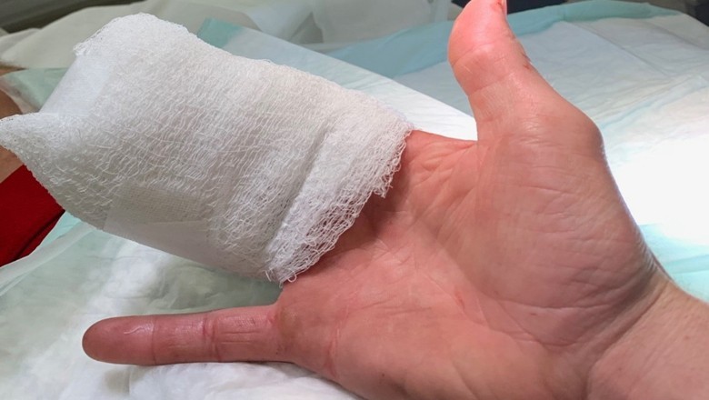 Kasur man cuts off worker’s fingers for demanding salary