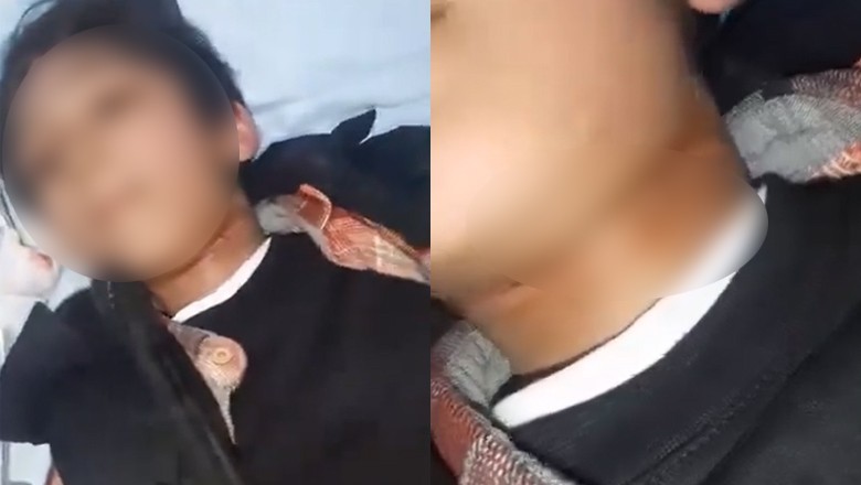 Kite string injures minor boy in Islamabad