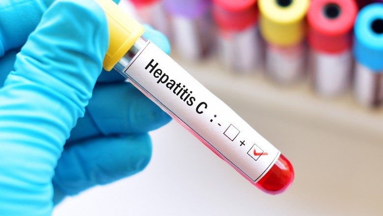 Pakistan ranked first in world with over 8 million hepatitis C cases