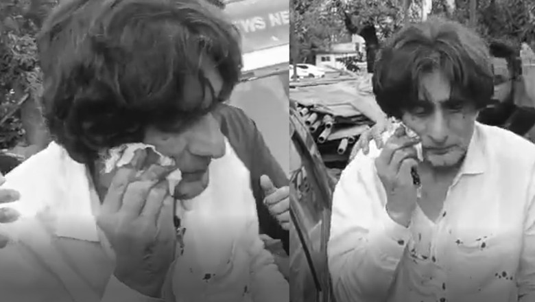 PTI's Raoof Hasan injured in 'targeted attack' in Islamabad