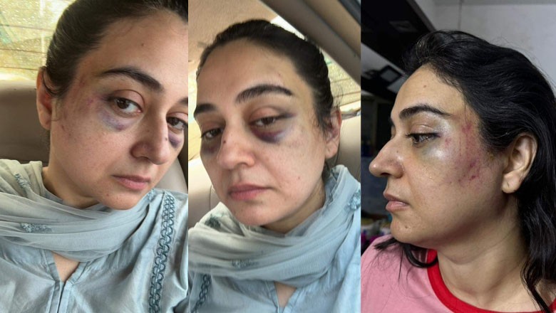 Anchorperson Ayesha Jahanzeb beaten up by her husband