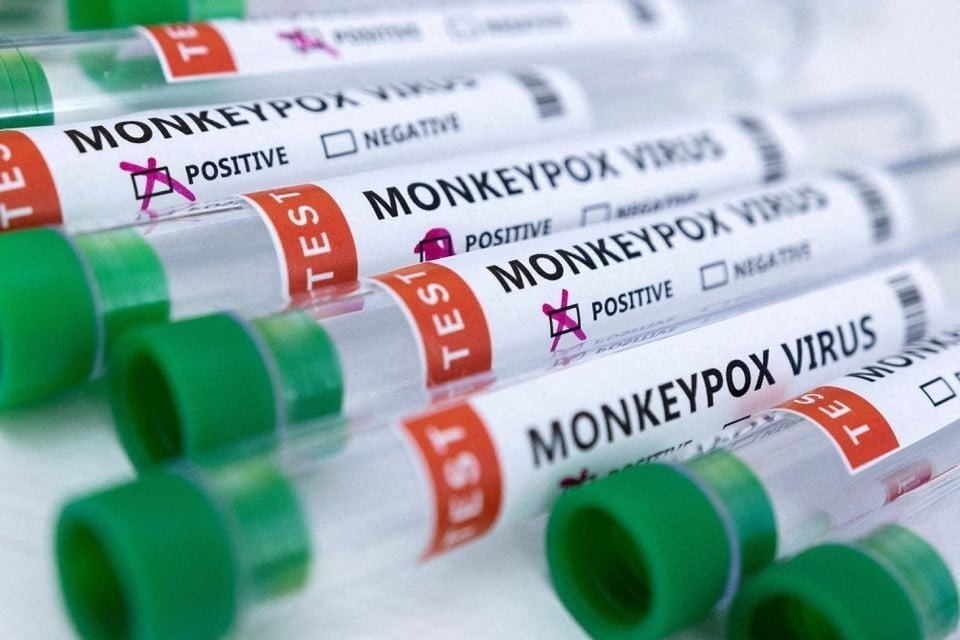 Pakistan reports fourth monkeypox case of 2024