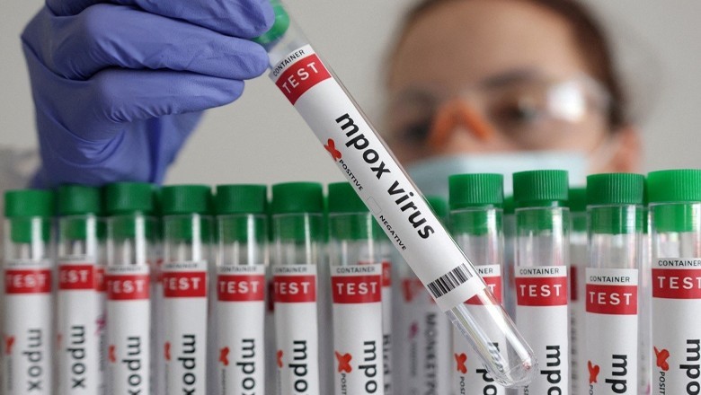 Karachi reports three suspected mpox cases in a single day