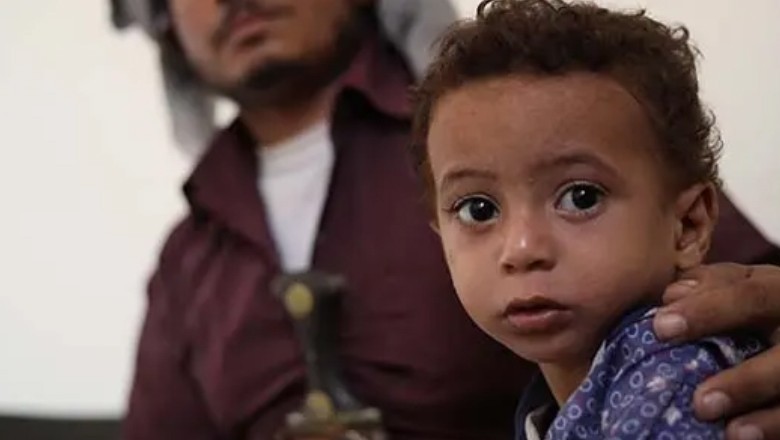 Over 11 million children under five in Punjab face health risks from toxic smog: UNICEF