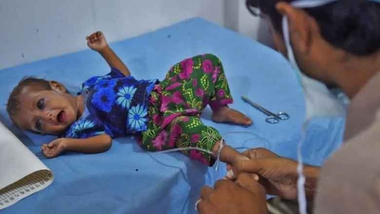 Malnutrition costs Pakistan $17 Billion annually, report reveals